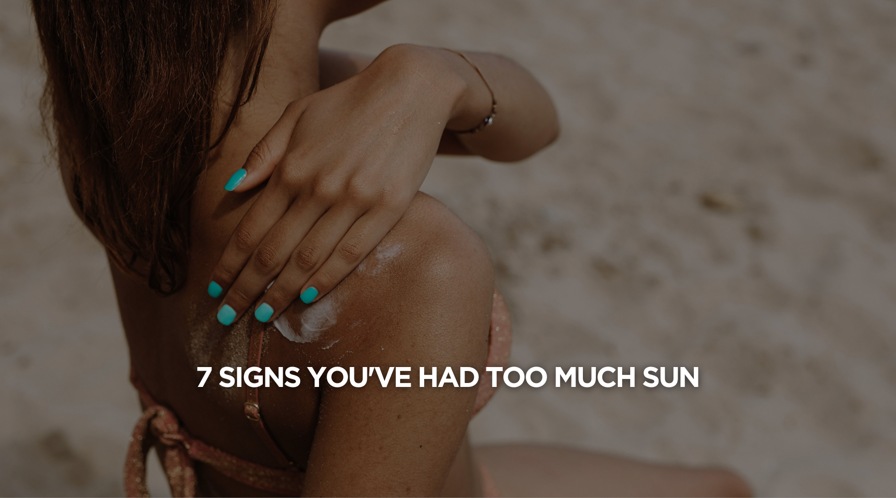 7 Signs You've Had Too Much Sun
