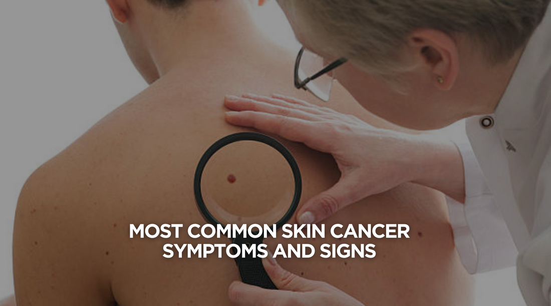 Most Common Skin Cancer Symptoms and Signs