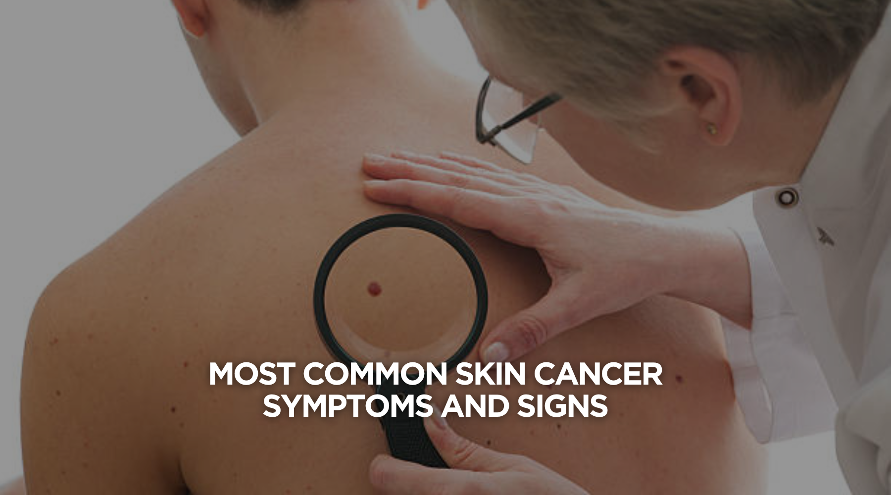Most Common Skin Cancer Symptoms and Signs