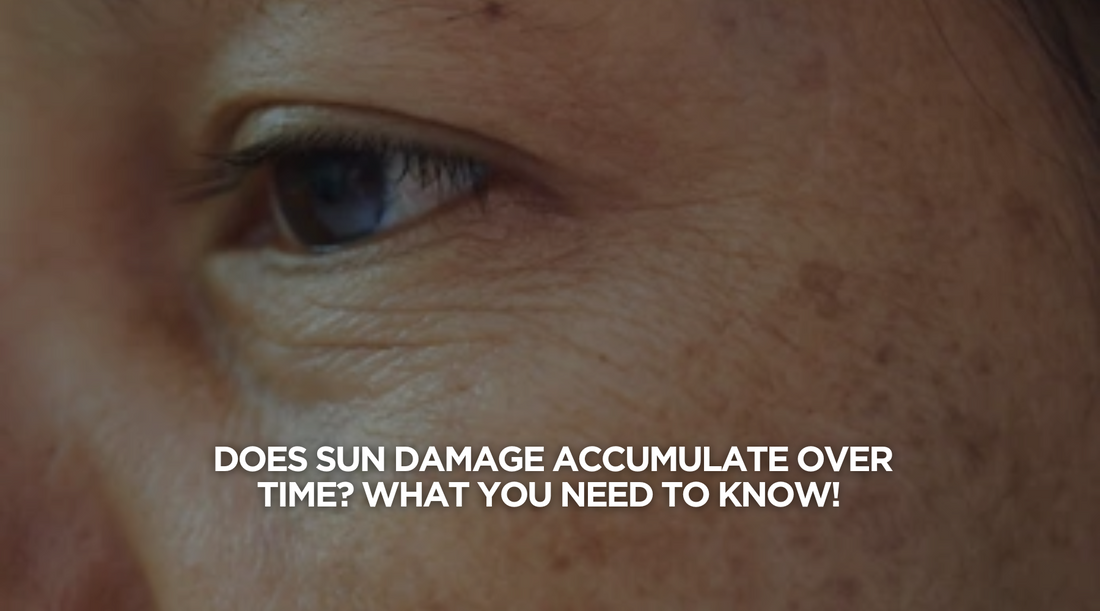 Does Sun Damage Accumulate Over Time? Here’s What You Need to Know