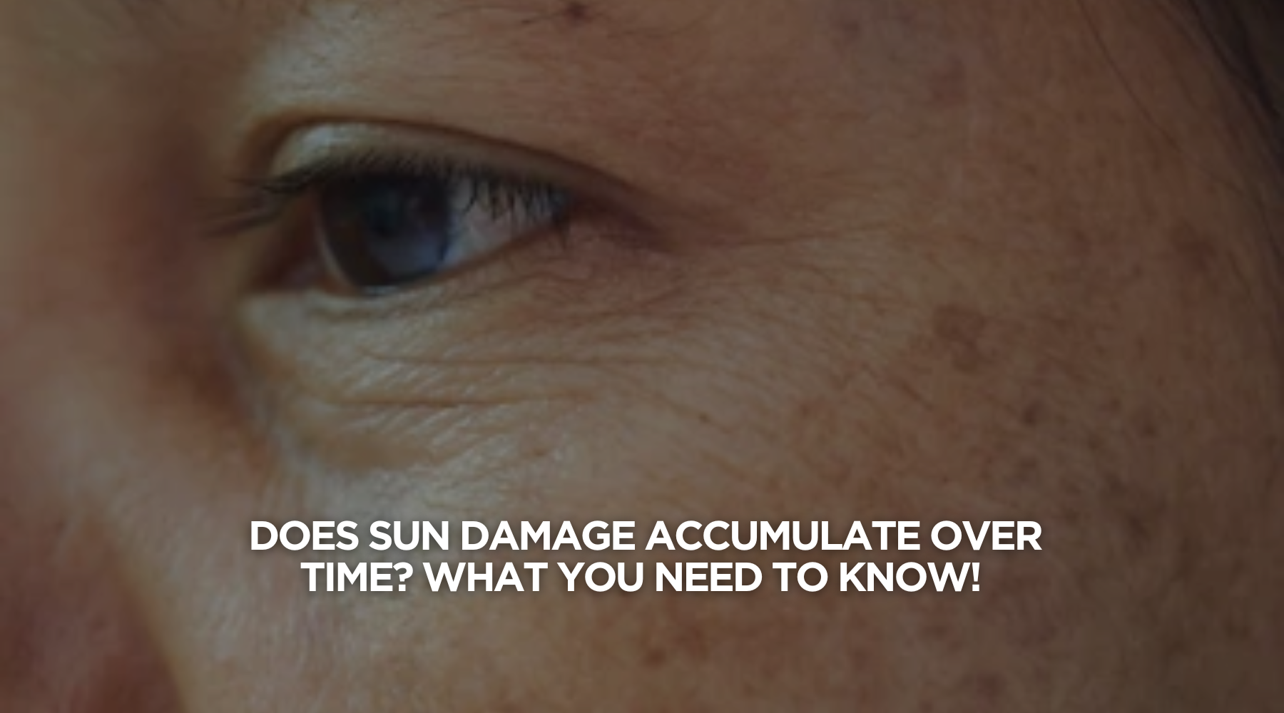 Does Sun Damage Accumulate Over Time? Here’s What You Need to Know